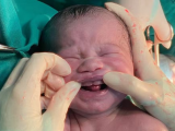 Bebê nasce com seis dentes e chama atenção nas redes sociais
