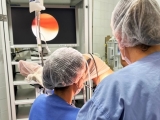 Hospital da Mulher realiza primeiro mutirão de histeroscopia